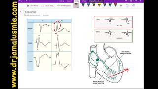 LBBB and RBBB left VS right bundle branch block Dr Jamal USMLE  Cardiology ECG lecture [upl. by Caesaria342]