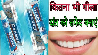 अपने पीले दांतो के सिर्फ 2 दिन में उजला करे  cavisan toothpaste full review in Hindi [upl. by Samul]