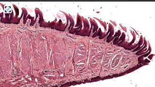 Histology of tongue filiform and fungiform papillae [upl. by Anyela]