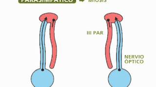 Reflejos pupilares  Oftalmología [upl. by Eleen555]