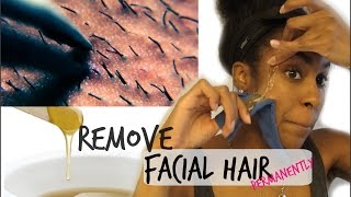 SKIN How to Remove Facial Hair Permanently [upl. by Rue849]