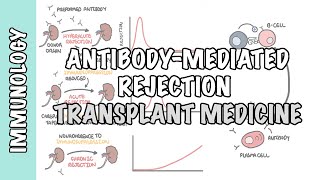 Transplant Medicine  Antibody mediated rejection [upl. by Ennazzus]