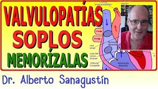 Memoriza las VALVULOPATÍAS y SOPLOS ✅ rápido y fácil [upl. by Zoe]