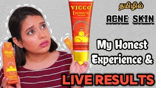 I TRIED VICCO CREAM FOR A WEEK ON ACNE SKIN AND THIS HAPPENED  Vicco Turmeric cream Review in Tamil [upl. by Siuol632]