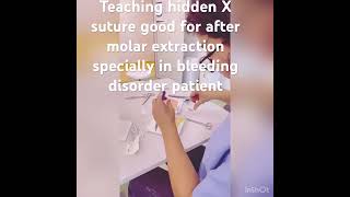 X suturetrending shortfeed shortsviral today shorts music story dentist [upl. by Ferrand]