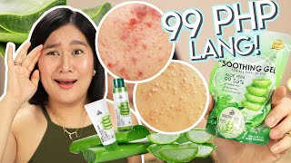 99 PHP na ANTI BUTLIG at ANTI TIGYAWAT Aloe Vera ni Luxe Organix  Kris Lumagui [upl. by Eninaj]