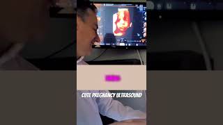 Crying in dad issues 😩 pregnancyannouncement babyultrasound bebe [upl. by Britteny328]