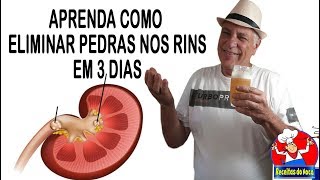 Elimine PEDRA NO RIM EM 3 DIAS tomando isso [upl. by Sedrul]