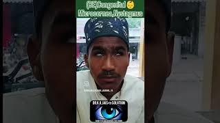 BECONGENITAL MICROCORNEA  NYSTAGMUS eyetreatment eyedoctor eyecondition DrAanchalMD [upl. by Veta]