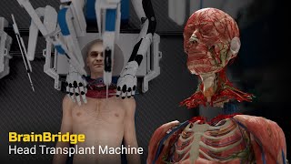 Worlds FIRST head transplant system has been unveiled human head transplant progress [upl. by Dibru391]