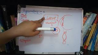 HYPERMETROPIA important topic full explanation part 1 [upl. by Trace]