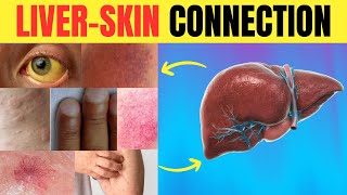 😱 Is Your Skin SCREAMING for Help 🆘 11 LIVER WARNING Signs You Might Miss  Longevity Deprocessed [upl. by Leonidas]