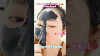 blackwhite heads removal！ blackheadsremoval 黑头粉刺 黑头粉刺说拜拜 beauty 分享好物 日常vlog 测评 [upl. by Malaspina695]