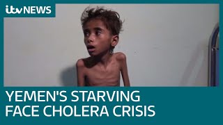 Yemens starving now face worlds worst cholera outbreak  ITV News [upl. by Telocin]