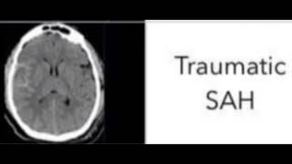 Types of head injury and treatment pls support my channel 🙏🙏 like and subscribe 🙏 [upl. by Mika]