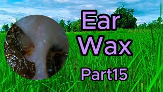 ear wax removal asmr roleplay [upl. by Ylrebmik695]