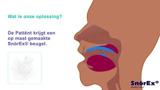 Oplossing tegen snurken [upl. by Rollins]