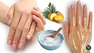 How To Remove Wrinkles From Hands Naturally in 2 Days [upl. by Nidnerb]