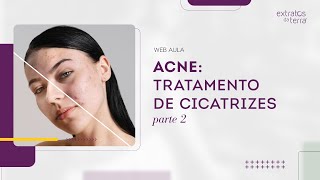 Cicatriz de Acne Plano de Tratamento Completo  Web Aula Gratuita 172 [upl. by Anatollo]