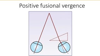 Orthopics series 5  Positive fusional vergence  PFV [upl. by Reeher478]