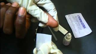 HIV Antibody Test Using A Rapid HIV Card [upl. by Aciemaj]