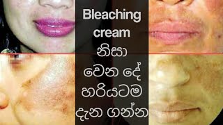 SIDE EFFECTS OF BLEACHING CREAM SINHALA whiteningcream bleachingcreamsideeffects bannedcream [upl. by Bailie]