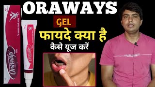 oraways gel uses in hindi  oraways kaise use kare  oraways gel  oraways mouth ulcer gel [upl. by Emilee]