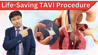 Explaining TAVI for Aortic Valve in Simple Terms [upl. by Elaina]