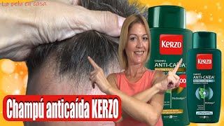 Tratamiento para la Caída del Cabello Graso  Cómo Frenar la Caída del Cabello  Champú menta KERZO [upl. by Sekoorb]