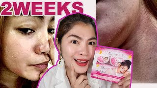 BRILLIANT SKIN REJUVENATING SET  IWASAN ANG Kati Hapdi PAMUMULA TIPS  HONEST REVIEW NO TO SUNOG [upl. by Klein]