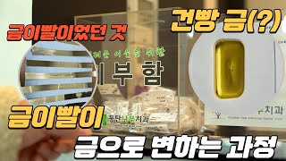 금이빨에 금이 얼마나 나올까ㅋㅋㅋ [upl. by Ecinad]