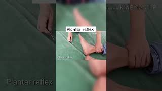 Planter Reflex  Clinical Examination of Reflex reflexes clinical physiology [upl. by Elly398]