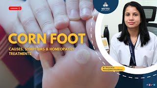 Corn Foot Causes and Prevention  Dr Divya Amit  Homeopathy Insights [upl. by Amadis661]