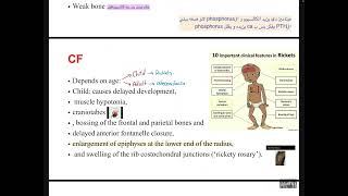 MBD4osteoporosis and osteomalacia [upl. by Kimball]