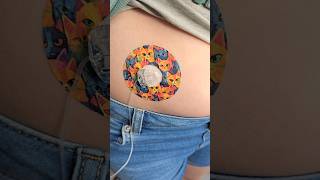 Insulin Pump Change  She needs a reload every 3 days diabetes t1d diabadass typeonediabetes [upl. by Peppie]