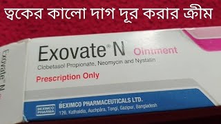 ত্বকে Exovate Nক্রীম এর কাজ কিকালো দাগ দূর করার কার্যকরী ক্রিম এবং এর উপকারিতা। [upl. by Aihsyak592]