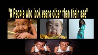 8 People Who Look Years Older Than Their Age [upl. by Pren]