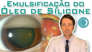 Recuperação Pós Vitrectomia Retirada do Óleo de Silicone  Cirurgia de Catarata Facectomia [upl. by Deirdre]