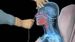 How to insert a nasogastric tube for NG intubation  3d animation [upl. by Dot]