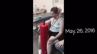 C3 C4 C5 Spinal Cord Injury Sitting Balance [upl. by Gabrila726]