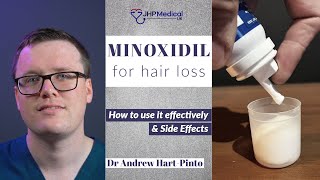 MINOXIDIL treatment for HAIR LOSS  How and When to use  What Patients Need to Know [upl. by Ccasi]