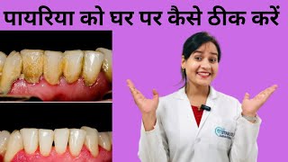 पायरिया को घर पर कैसे ठीक करें Home Remedies For pyorrhea pyorrhea [upl. by Iralam]