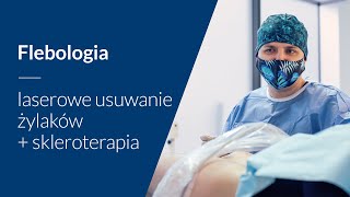 Laserowe zamknięcie żył i skleroterapia hybrydowe leczenie żylaków [upl. by Ydna208]