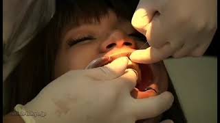 REAL PERSON DENTAL ASMR 4 🦷 EXAM AND ULTRASONIC SCALING TREATMENT [upl. by Denison605]