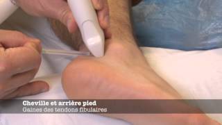 Echomsinfo  Gaine des tendons fibulaires [upl. by Annyahs]