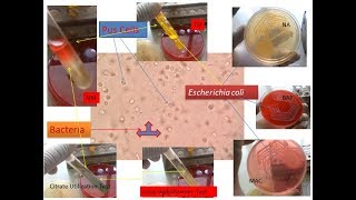 E coli and pus cells in urine [upl. by Wilbert482]