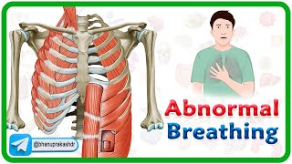 Accessory muscle Breathing Agonal Breathing Apneustic breathing Asterixis and Biots Breathing [upl. by Ikim]