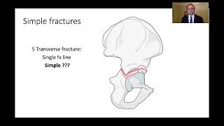 Kasr Al Ainy Postgraduate Orthopaedic Review Course  Acetabular Fractures Principles of Management [upl. by Einnok585]