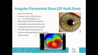 Webinar Adv Customization with Atlantis Scleral for Regular and Irregular Corneas 3DVault and MF [upl. by Nolyaj]