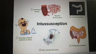 Intussusception part 1 [upl. by Bondie]